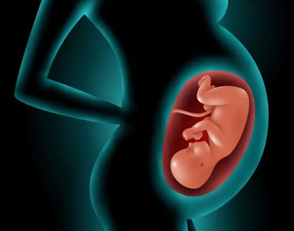 Medical Termination of pregnancy